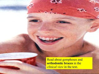 Read about gomphoses and  orthodontic braces  in the  clinical view  in the text. 