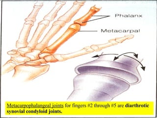 Metacarpophalangeal joints  for fingers #2 through #5 are  diarthrotic synovial condyloid joints. 