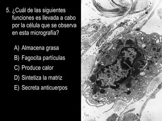 5. ¿Cuál de las siguientes
   funciones es llevada a cabo
   por la célula que se observa
   en esta micrografía?

   A) Almacena grasa
   B) Fagocita partículas
   C) Produce calor
   D) Sintetiza la matriz
   E) Secreta anticuerpos
 