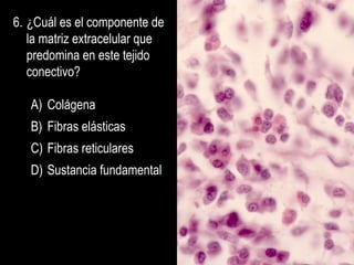 6. ¿Cuál es el componente de
   la matriz extracelular que
   predomina en este tejido
   conectivo?

   A) Colágena
   B) Fibras elásticas
   C) Fibras reticulares
   D) Sustancia fundamental
 