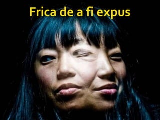 Frica de a fi expus 