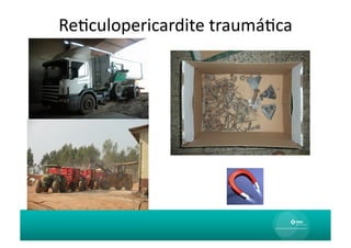 ReAculopericardite	
  traumáAca	
  
 