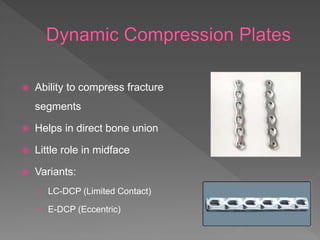 osteosynthesis materials and systems | PPTX