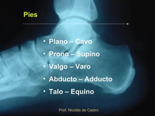 Pies


       • Plano – Cavo
       • Prono – Supino
       • Valgo – Varo
       • Abducto – Adducto
       • Talo – Equino

           Prof. Nicolás de Castro
 