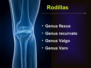 Rodillas


• Genus flexus
• Genus recurvato
• Genus Valgo
• Genus Varo
 