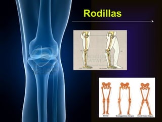 Rodillas
 