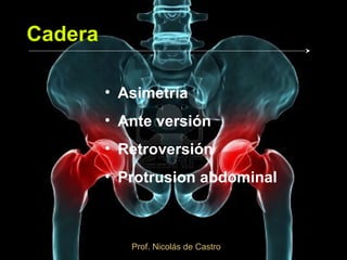 Cadera

         • Asimetría
         • Ante versión
         • Retroversión
         • Protrusion abdominal



            Prof. Nicolás de Castro
 