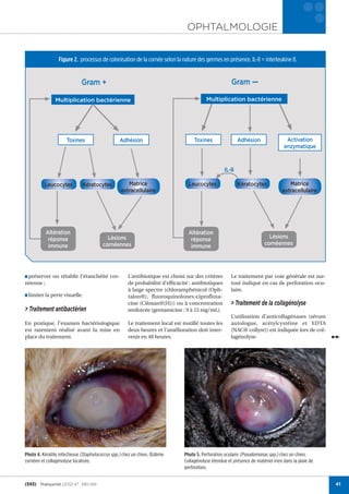 OPHTALMOLOGIE
                                                                                                                                          j
                 Figure 2. processus de colonisation de la cornée selon la nature des germes en présence. IL-8 = interleukine 8.


                             Gram +                                                                   Gram —

               Multiplication bactérienne                                                Multiplication bactérienne




                     Toxines                     Adhésion                          Toxines                Adhésion                 Activation
                                                                                                                                  enzymatique


                                                                                                   IL-8

          Leucocytes         Kératocytes            Matrice                     Leucocytes                Kératocytes               Matrice
                                                 extracellulaire                                                                 extracellulaire




          Altération                                                            Altération
           réponse                        Lésions                                réponse                                  Lésions
           immune                       cornéennes                               immune                                 cornéennes




■ préserver ou rétablir l’étanchéité cor-            L’antibiotique est choisi sur des critères       Le traitement par voie générale est sur-
néenne ;                                             de probabilité d’efﬁcacité : antibiotiques       tout indiqué en cas de perforation ocu-
                                                     à large spectre (chloramphénicol (Oph-           laire.
■ limiter la perte visuelle.                         talon®), fluoroquinolones-ciprofloxa-
                                                     cine (Ciloxan®[H])) ou à concentration           > Traitement de la collagénolyse
> Traitement antibactérien                           renforcée (gentamicine : 9 à 15 mg/mL).
                                                                                                      L’utilisation d’anticollagénases (sérum
En pratique, l’examen bactériologique                Le traitement local est instillé toutes les      autologue, acétylcystéine et EDTA
est rarement réalisé avant la mise en                deux heures et l’amélioration doit inter-        (NAC® collyre)) est indiquée lors de col-
place du traitement.                                 venir en 48 heures.                              lagénolyse.




Photo 4. Kératite infectieuse (Staphylococcus spp.) chez un chien. Œdème
                                                  )                           Photo 5. Perforation oculaire (Pseudomonas spp.) chez un chien.
                                                                                                                              )
cornéen et collagénolyse localisée.                                           Collagénolyse étendue et présence de matériel irien dans la plaie de
                                                                              perforation.


(593) PratiqueVet (2012) 47 : 590-594                                                                                                                41
 