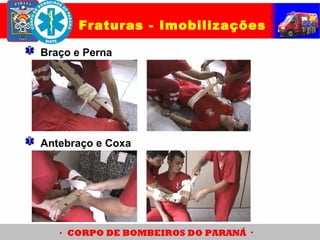 Fraturas - Imobilizações
Braço e Perna
Antebraço e Coxa
 