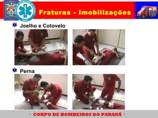 Fraturas - Imobilizações
Joelho e Cotovelo
Perna
 