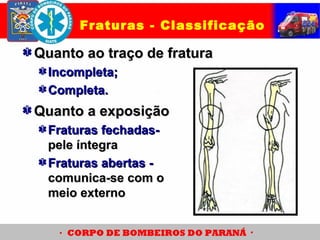 Quanto ao traço de fraturaQuanto ao traço de fratura
Incompleta;Incompleta;
Completa.Completa.
Fraturas - Classificação
Quanto a exposiçãoQuanto a exposição
Fraturas fechadas-Fraturas fechadas-
pele íntegrapele íntegra
Fraturas abertas -Fraturas abertas -
comunica-se com ocomunica-se com o
meio externomeio externo
 