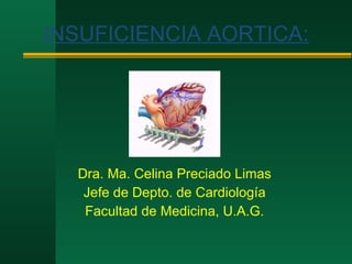 INSUFICIENCIA AORTICA : Dra. Ma. Celina Preciado Limas Jefe de Depto. de Cardiología Facultad de Medicina, U.A.G. 