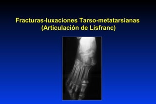 Fracturas-luxaciones Tarso-metatarsianas
        (Articulación de Lisfranc)
 