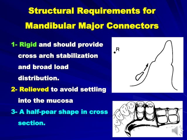 Mandibular major connectors and minor connectors | PPT | Oral care ...
