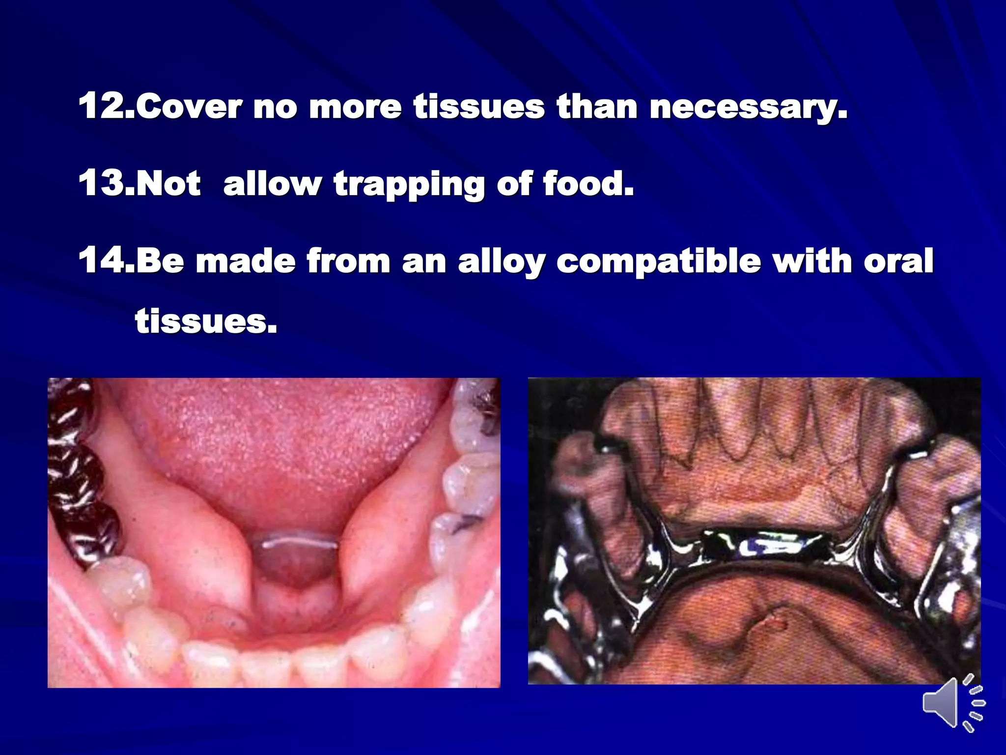 Substandard Rpds Mandibular major and minor connectors of RPDs | PPT