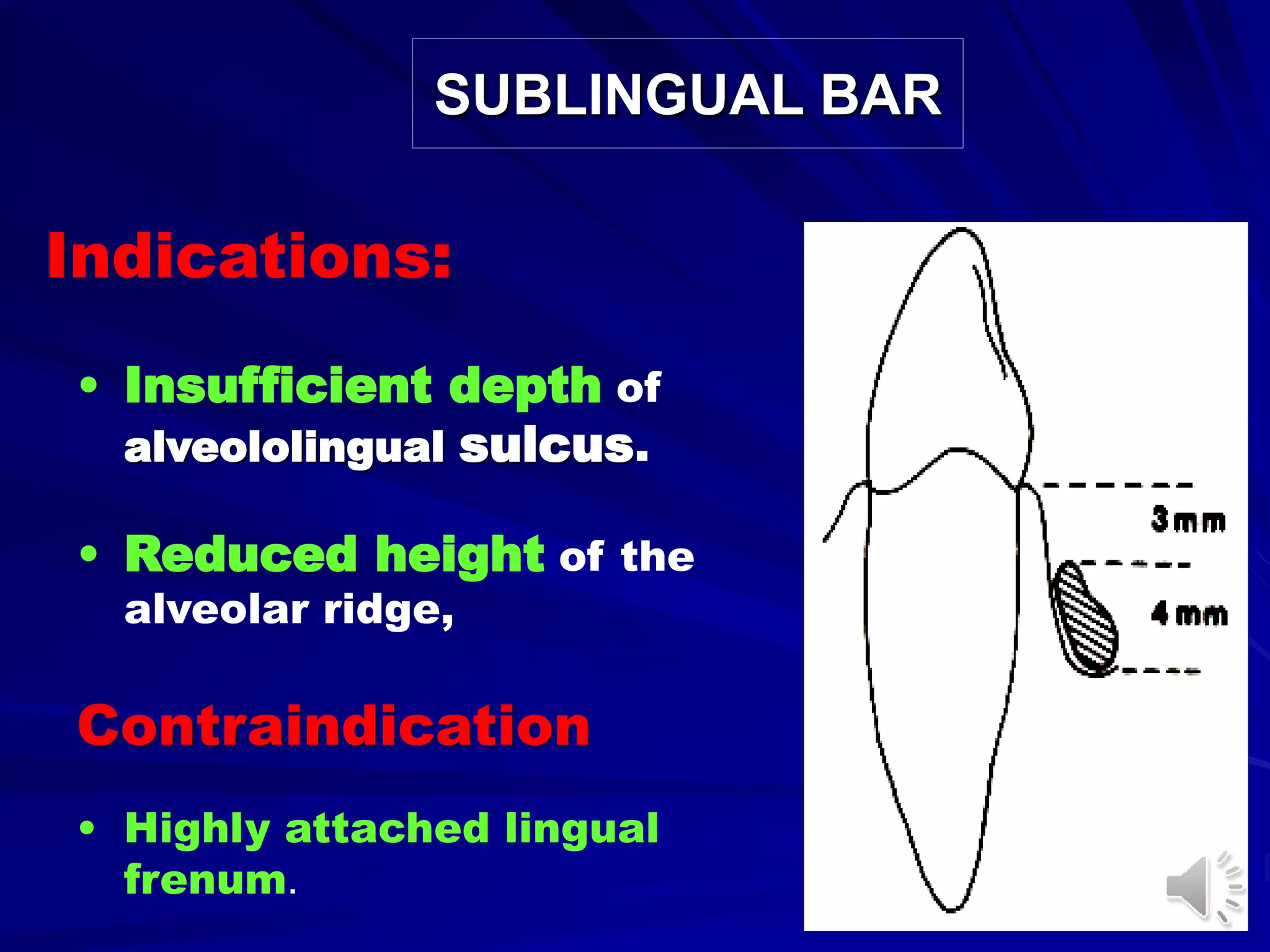 Substandard Rpds Mandibular major and minor connectors of RPDs | PPT