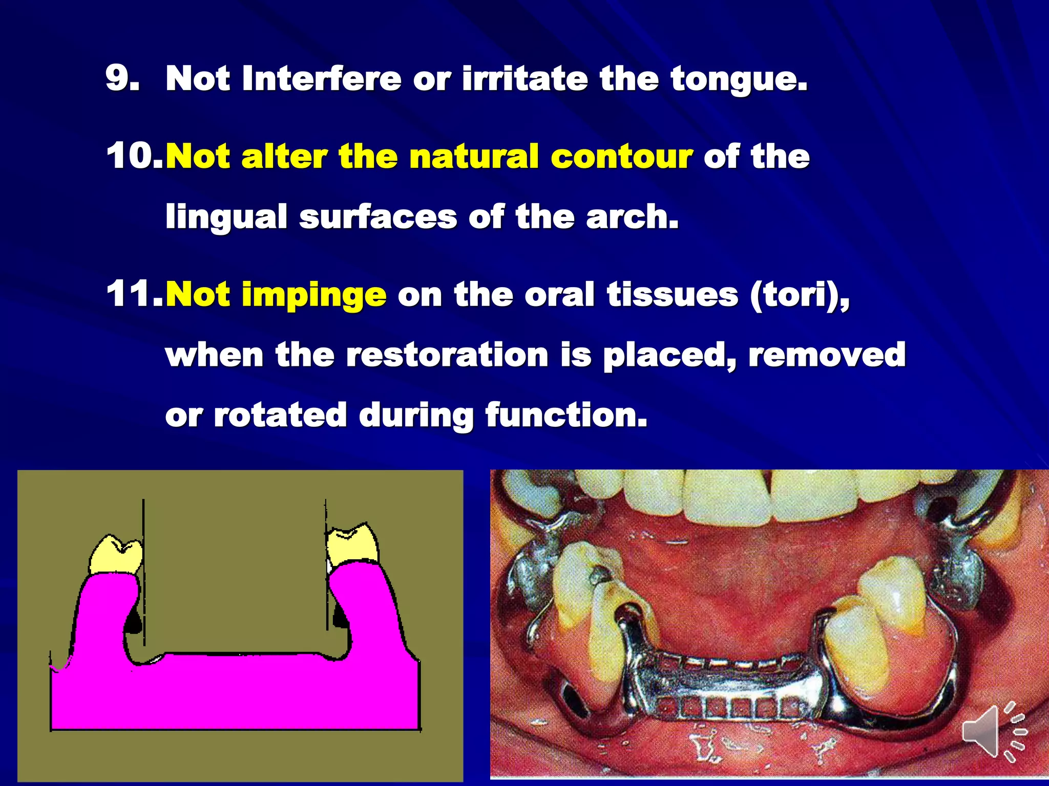 Mandiblar Rpd Mandibular major and minor connectors of RPDs | PPT
