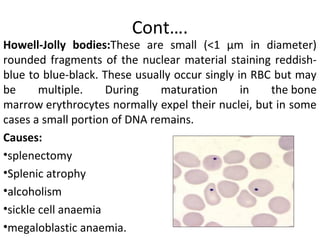 Howell Jolly Rbc morphology of red blood cells | PPT
