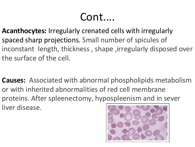rbc morphology abnormal