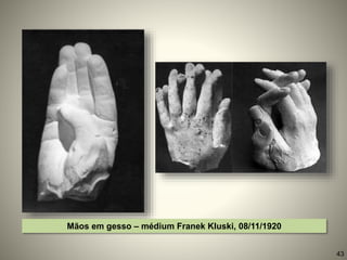 Mãos em gesso – médium Franek Kluski, 08/11/1920
43
 