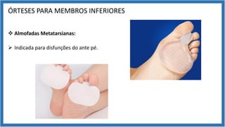 ÓRTESES PARA MEMBROS INFERIORES
v Almofadas Metatarsianas:
Ø Indicada para disfunções do ante pé.
 