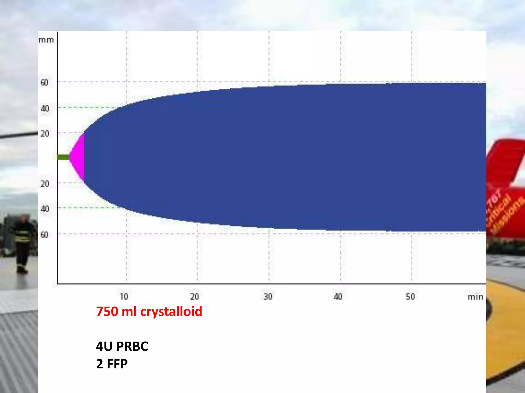 750 ml crystalloid
4U PRBC
2 FFP
 