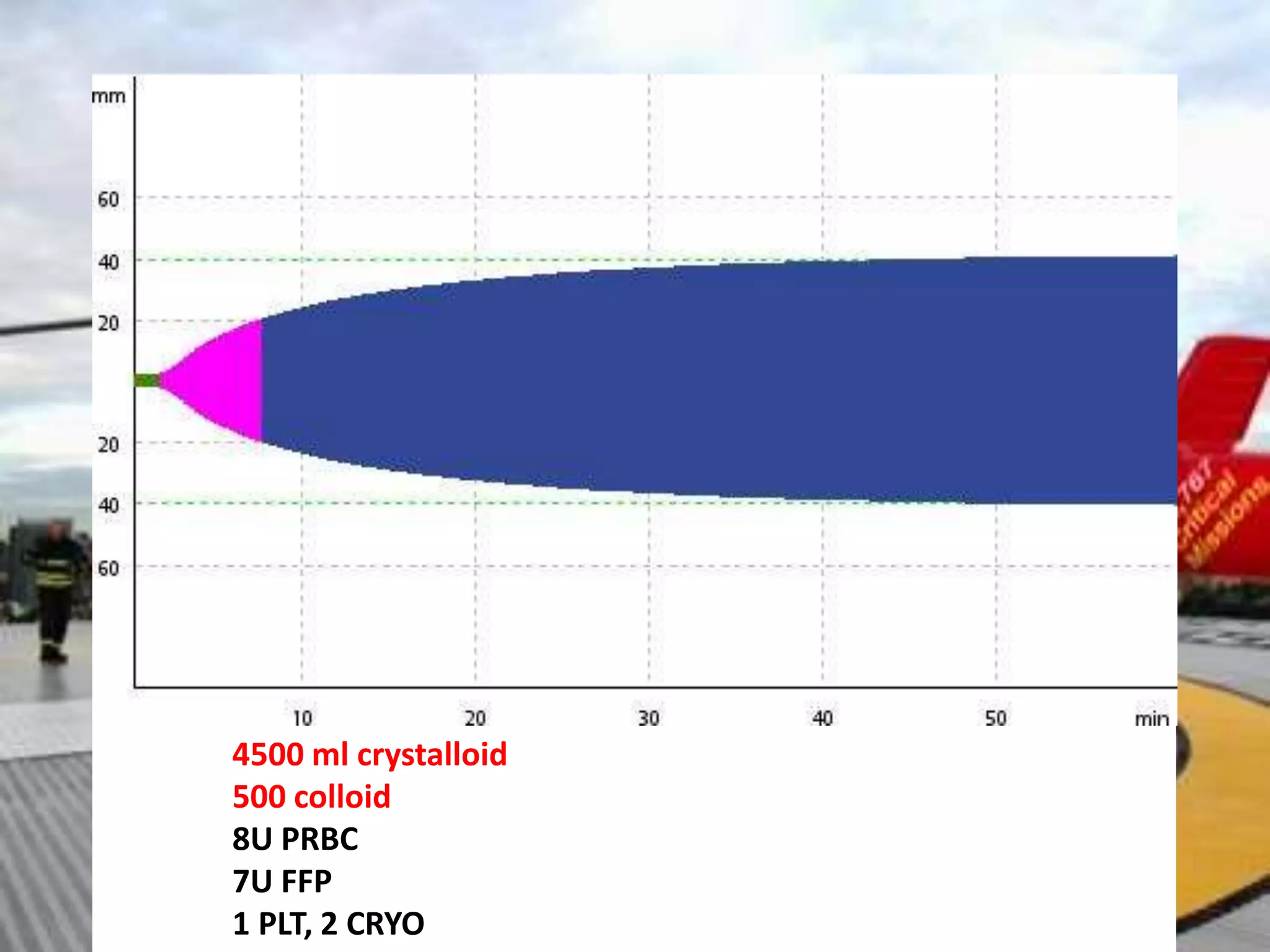 4500 ml crystalloid
500 colloid
8U PRBC
7U FFP
1 PLT, 2 CRYO
 