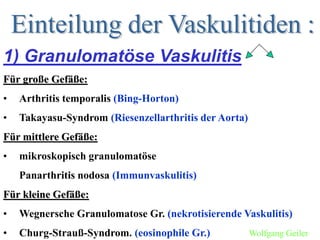 1) Granulomatöse Vaskulitis
Für große Gefäße:
• Arthritis temporalis (Bing-Horton)
• Takayasu-Syndrom (Riesenzellarthritis der Aorta)
Für mittlere Gefäße:
• mikroskopisch granulomatöse
Panarthritis nodosa (Immunvaskulitis)
Für kleine Gefäße:
• Wegnersche Granulomatose Gr. (nekrotisierende Vaskulitis)
• Churg-Strauß-Syndrom. (eosinophile Gr.) Wolfgang Geiler
 