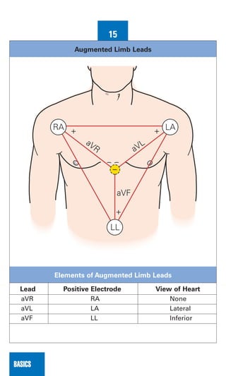 0803613474 - ECG Notes Interpretation And Management Guide.pdf