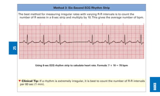 0803613474 - ECG Notes Interpretation And Management Guide.pdf