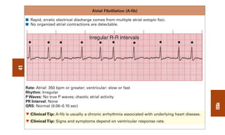0803613474 - ECG Notes Interpretation And Management Guide.pdf