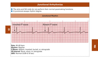 0803613474 - ECG Notes Interpretation And Management Guide.pdf