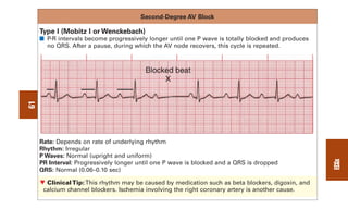 0803613474 - ECG Notes Interpretation And Management Guide.pdf