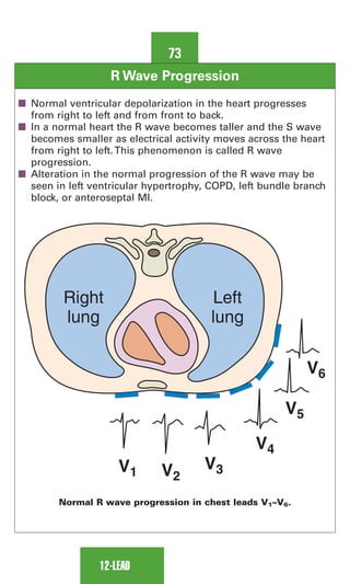 0803613474 - ECG Notes Interpretation And Management Guide.pdf