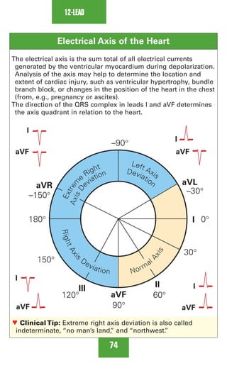 0803613474 - ECG Notes Interpretation And Management Guide.pdf