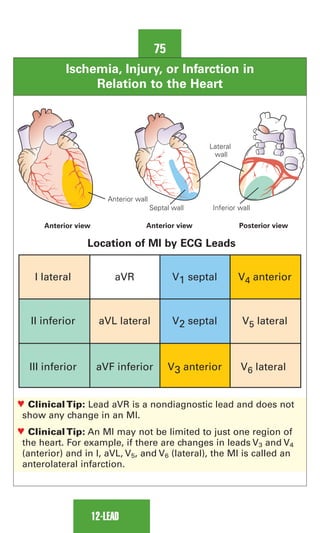 0803613474 - ECG Notes Interpretation And Management Guide.pdf
