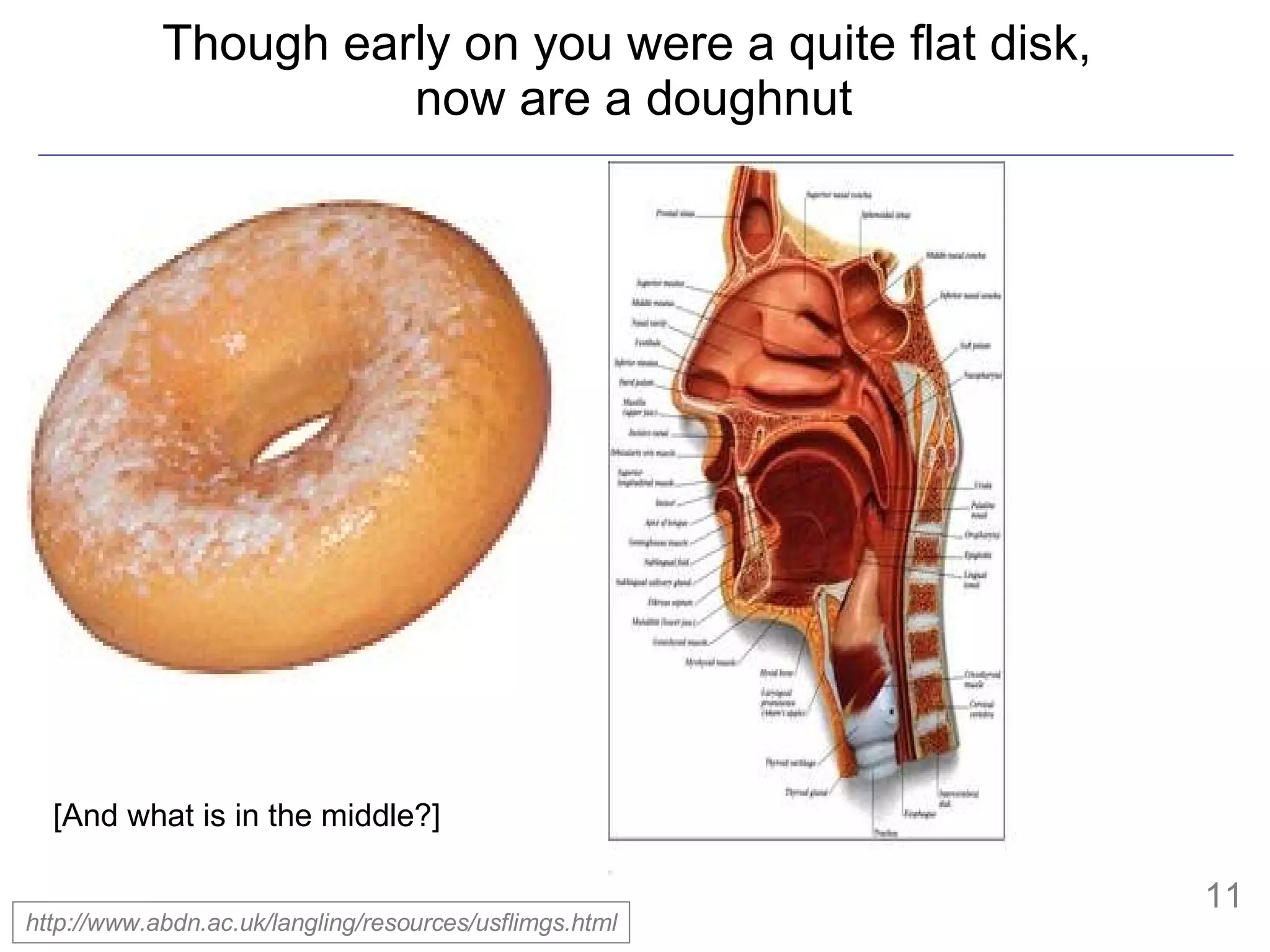 Though early on you were a quite flat disk,  now are a doughnut http://www.abdn.ac.uk/langling/resources/usflimgs.html [And what is in the middle?] 