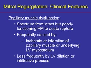 Papillary Dysfunction 081908.MShea_.MitralAorticValveDisease.ppt