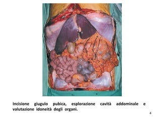 Il prelievo multiorgano nel donatore a cuore battente: principi di ...