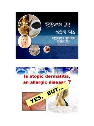 대젂대학교 핚의학과
              김동희 교수
               dhkim@dju.kr




Is atopic dermatitis,
an allergic disease ?
 