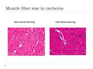 082409 understanding cachexia | PPT