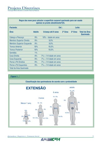 5Queimaduras: Diagnóstico e Tratamento Inicial
Projeto Diretrizes
Associação Médica Brasileira e Conselho Federal de Medicina
Regra dos nove para calcular a superfície corporal queimada para ser usada
apenas no pronto atendimento6
(D).
Paciente: Enf.: Leito:
Área Adulto Criança até 9 anos 2º Grau 3º Grau Total da Área
Queimada
Cabeça e Pescoço 9% 18% - idade em anos
Membro Superior Direito 9% 9,0%
Membro Superior Esquerdo 9% 9,0%
Tronco Anterior 18% 18,0%
Tronco Posterior 18% 18,0%
Genitália 1%
Coxa Direita 9% 7% + 1/4 idade em anos
Coxa Esquerda 9% 7% + 1/4 idade em anos
Perna e Pé Direitos 9% 7% + 1/4 idade em anos
Perna e Pé Esquerdos 9% 7% + 1/4 idade em anos
Total da Área Queimada
Figura 1
Classificação das queimaduras de acordo com a profundidade
EXTENSÃO
Menor 1 ano
18%
9%
14%
9%
14%
14+1,5% 14+1,5%
14+3%
14+3%
14+4%
9%
9%
9%9%
18 - 3%
3 anos
18 - 6%
6 anos
9%
adulto
18 - 9%
9%
14+4%
% %136
%36
36%
36%
 