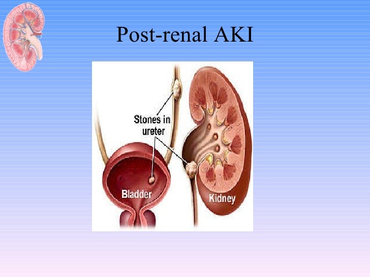 08 al ghonaim approach to acute renal failure 11 728