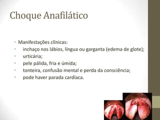 Choque Anafilático
• Manifestações clínicas:
• inchaço nos lábios, língua ou garganta (edema de glote);
• urticária;
• pele pálida, fria e úmida;
• tonteira, confusão mental e perda da consciência;
• pode haver parada cardíaca.

 