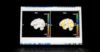 Brain scan of a child on the autism spectrum | Curtis Cripe