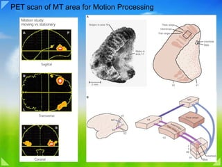 PET scan of MT area for Motion Processing 