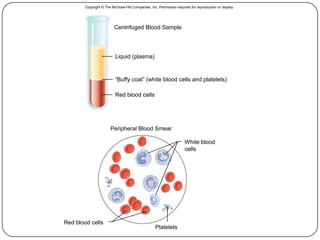 5
Copyright © The McGraw-Hill Companies, Inc. Permission required for reproduction or display.
Centrifuged Blood Sample
Peripheral Blood Smear
Liquid (plasma)
“Buffy coat” (white blood cells and platelets)
Red blood cells
Red blood cells
Platelets
White blood
cells
 