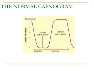 THE NORMAL CAPNOGRAM 