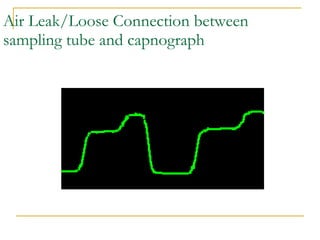 Air Leak/Loose Connection between sampling tube and capnograph 