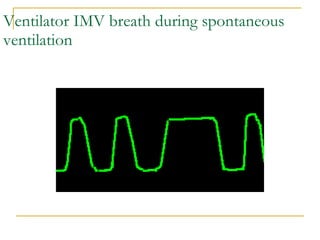 Ventilator IMV breath during spontaneous ventilation 